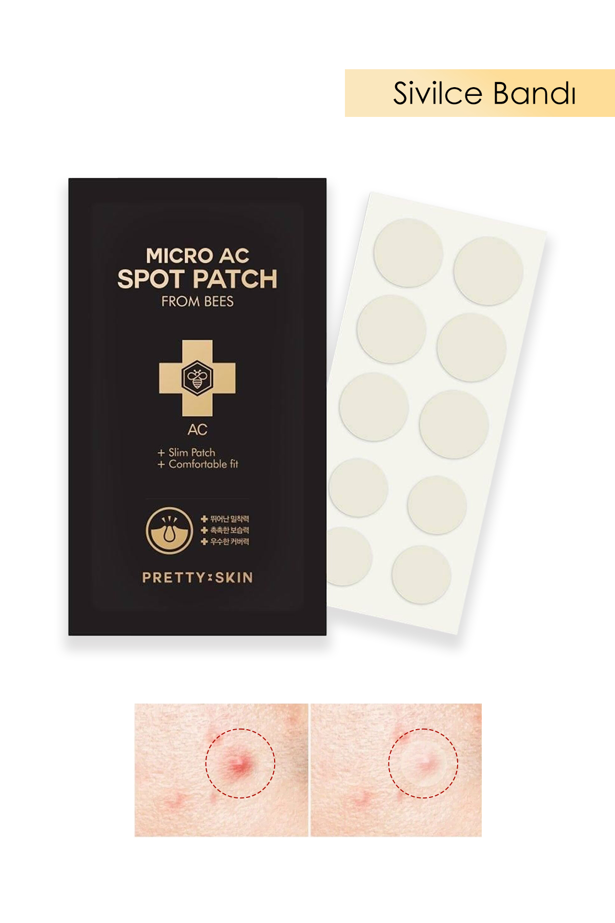 PRETTYSKIN Arı Zehri İçeren Şeffaf Akne&Sivilce Karşıtı Bant 10 Adet Micro AC Spot Patch From Bees